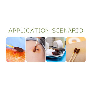 KANMINE 멸균 요오드 소독제 포비돈-요오드 액체 적신 면 스틱 면봉 요오드 포 CE 인증 개별 포장 - Product Image 5