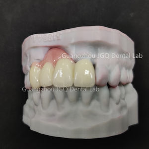 Couronnes et ponts dentaires <span class=keywords><strong>en</strong></span> <span class=keywords><strong>zircone</strong></span> <span class=keywords><strong>en</strong></span> couches de porcelaine avec gomme <span class=keywords><strong>en</strong></span> porcelaine pour dents antérieures - Product Image 5