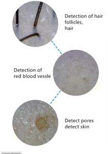 Analyseur professionnel de cheveux de peau avec l'écran de 9 pouces pour la machine de soins de la peau prête à expédier - Product Image 6