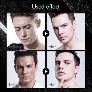 OEM <span class=keywords><strong>Set</strong></span> per la cura della pelle da <span class=keywords><strong>uomo</strong></span> con Mousse a controllo dell'olio e schiuma detergente sbiancante crema per il viso idratante per la cura del viso <span class=keywords><strong>Set</strong></span> da <span class=keywords><strong>uomo</strong></span> - Product Image 3