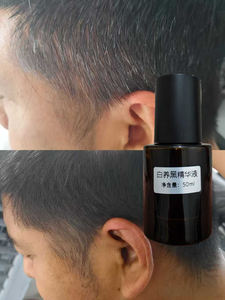 Alta calidad <span class=keywords><strong>Natural</strong></span> Polygonum Multiflorum Fo-ti Anti Grey Hair Prevention Care White Hair to Black <span class=keywords><strong>Tratamiento</strong></span> Suero permanente - Product Image 2