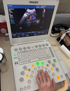 Fourniture et réparation de la machine à ultrasons portable CX50 - Product Image 6