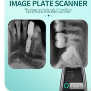 Escáner de Placas de Fósforo Dental de Alta Velocidad con Imágenes Nítidas para Clínica Dental, Escáner Digital de Placas de Imagen Dental - Product Image 6