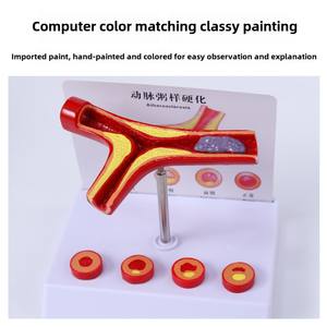 Yaşlılar İçin Deren DR Koronari Arter Kardiyovasküler Modeli Tromboz Kalp Hemşiresi Eğitimi Tıp Bilimi Sertleştirme - Product Image 4