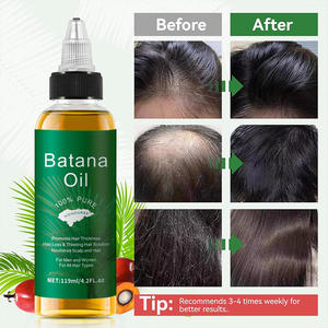 Olio Essenziale per Capelli Batana a Marchio Privato, Vendita Calda, Olio Organico Anti-Caduta per Uomini e Donne - Product Image 3