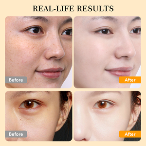 Máscara em Bastão de Argila e Cúrcuma para Cuidados Naturais com a Pele, Purificante, Limpeza Profunda, Controle de Oleosidade e Hidratação, Máscara de Chá de Cúrcuma - Product Image 5