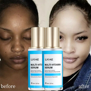 Boost Luster Professional Ser Bleach Black Skin Vc Glow idratante correzione pigmentazione siero Faciales - Product Image 1