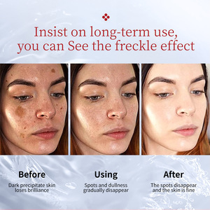 Crème éclaircissante <span class=keywords><strong>pour</strong></span> femmes, utilisation <span class=keywords><strong>de</strong></span> jour, élimine <span class=keywords><strong>les</strong></span> <span class=keywords><strong>taches</strong></span> solaires, <span class=keywords><strong>les</strong></span> <span class=keywords><strong>taches</strong></span> <span class=keywords><strong>de</strong></span> rousseur et la mélanine - Product Image 3