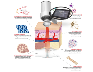 <span class=keywords><strong>Laser</strong></span> de physiothérapie de classe IV pour animaux de compagnie et humains, tissus profonds, 810 nm, 980 nm, 30 W, 60 W, pour la cicatrisation des plaies et le soulagement de la douleur - Product Image 5