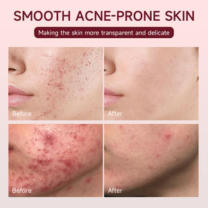 Crema Reparadora Iluminadora Correctora de Manchas Oscuras con Ácido Sazelaico, Ácido Tranexámico y Niacinamida para el Cuidado de la Piel y el Acné, Venta al por Mayor de Cosméticos Coreanos - Product Image 2