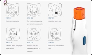 Dispositivo de Belleza Profesional <span class=keywords><strong>Wontech</strong></span> Oligio 6.78MHz Monopolar RF Antienvejecimiento, Lifting Facial y Reafirmación de la Piel - Product Image 3