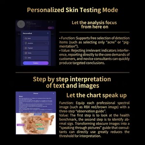 Popular One Scalp Analysis Handle, Máquina Analizadora de Piel, Dispositivo de Prueba para Predicción del Envejecimiento, Acné y Arrugas, para Spa de Belleza - Product Image 6
