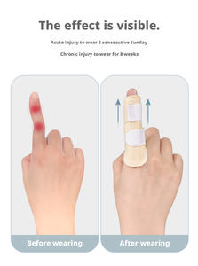 Férula Ajustable para Fijación de Dedos, Alivio del Dolor por Esguinces, Dislocaciones y Fracturas, Venta al Por Mayor - Product Image 2