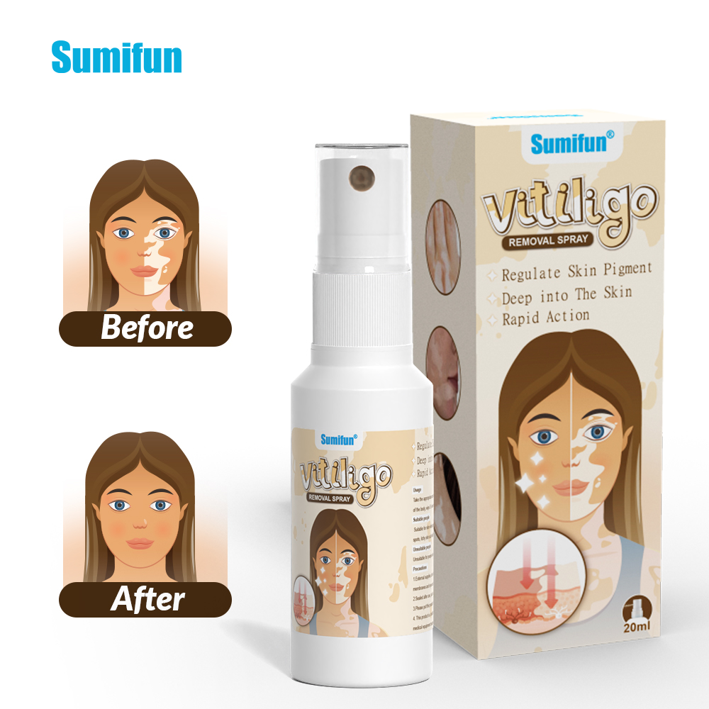 2025 New Arrival Sumifun White Spot Relief Spray for Skin Repair