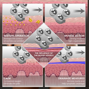 Machine à rouleaux pour <span class=keywords><strong>le</strong></span> corps, réduction de la cellulite, drainage lymphatique, rouleau sculptant, machine amincissante, massage - Product Image 2