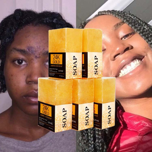 2025 nueva llegada 24K oro aminoácidos jabón hecho a mano blanqueamiento limpieza profunda aceite esencial jabón 200g para piel negra - Product Image 1