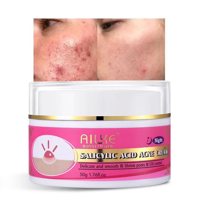 AILKE Private Label Treatment Face Acne Scar brufoli Remover acido salicilico crema per l'acne