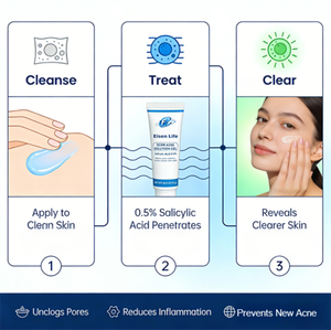 Gel Derm Acne Solution que promueve la curación del acné, antibacteriano <span class=keywords><strong>y</strong></span> antiinflamatorio preciso para reducir las cicatrices del acné - Product Image 4