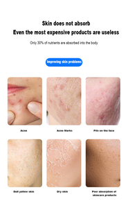 เครื่องมีโซกันเมโสแบบมีโซกันกำจัดริ้วรอยสำหรับดูแลผิวหน้า - Product Image 4