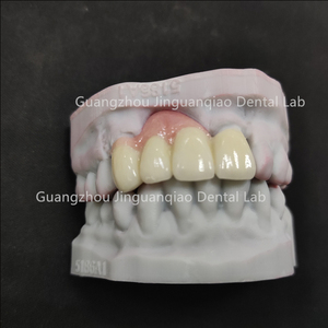 Proveedor de dentaduras personalizadas de alta precisión <span class=keywords><strong>CAD</strong></span>/CAM Dientes DE CIRCONIA sólida completa con precio competitivo para laboratorios dentales en el extranjero - Product Image 6