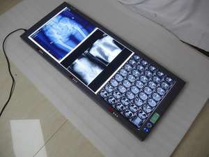 Boîte de vue médicale à rayons x, lumens, led, négatif oscope médical, luminosité réglable, Triple panneau, rayon X, vision dentaire - Product Image 2