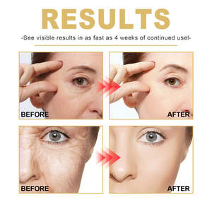 Siero Anti-età Bosman OEM Riduce le Rughe Sottili Idrata Ammorbidisce Illumina Ringiovanisce la Pelle - Product Image 4