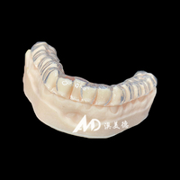 Protège-dents de nuit double couche souple et rigide |   Attelle occlusale hybride personnalisée pour les cliniques professionnelles