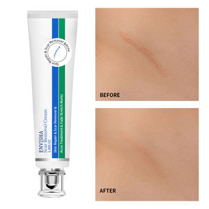 개인 라벨 피부 수리 스트레치 마크 퇴색 보습 잡티 제거 미백 흉터 제거 크림 - Product Image 2