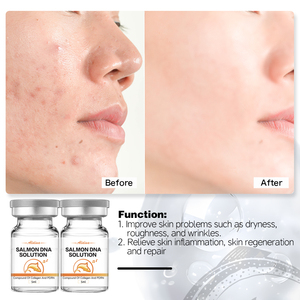 Private Label PDRN siero per il viso contiene sodio DNA riparazione e idratante Booster polinucleotidi riparazione salmone DNA siero B - Product Image 3