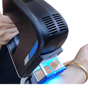 Lampu Laser Excimer UVB 308nm KN-5000D untuk Pengobatan Vitiligo - Product Image 5