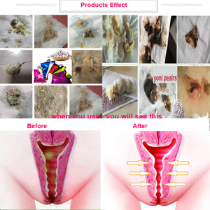 Perles de désintoxication vaginale naturelles à base de plantes, fourniture d'usine, logo personnalisé, tampons de nettoyage vaginal, perles Yoni biologiques - Product Image 6