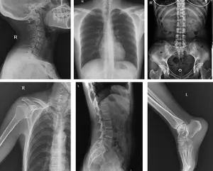 X-Ray สำหรับสัตว์เลี้ยงแบบพกพา Veterinary X Ray Vet เครื่อง X-Ray