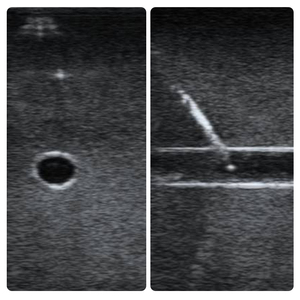 Modelo de Entrenamiento para Acceso <span class=keywords><strong>Vascular</strong></span> Guiado por Ultrasonido IG005-S1, 3 Vasos, Compatible con Bomba, Circulación, Fantoche Biónico para Punción <span class=keywords><strong>Vascular</strong></span> - Product Image 3
