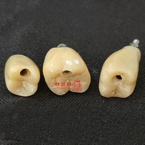 Couronnes d'implants avec excellente prothèse <span class=keywords><strong>dentaire</strong></span> plus confortables et plus belles que les prothèses et les ponts mobiles traditionnels - Product Image 1