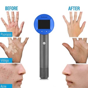 New Arrival bán đảo LED excimer vitiligo LED 308nm excimer Laser 308nm UVB cho hộ gia đình bệnh vẩy nến điều trị UVB phototherapy - Product Image 1