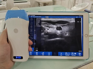 Meilleur prix pour un scanner linéaire sans fil noir et blanc à 128 éléments, équipement hospitalier, scanner linéaire, prix du scanner - Product Image 6