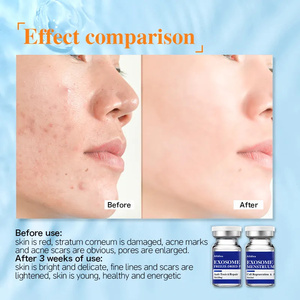 Kit Exo <span class=keywords><strong>Secret</strong></span> pour une <span class=keywords><strong>peau</strong></span> jeune Kit de poudre exo lyophilisée Kit de poudre de cellules souches exo spécialement pour l'acné et le vieillissement - Product Image 6