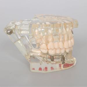 Modèle dentaire transparent de haute qualité, nouveau modèle d'affichage pathologique pour prothèses dentaires et implants - Product Image 6