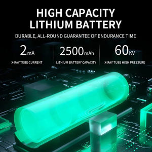 เครื่องเอกซ์เรย์ทันตกรรมแบบพกพาความถี่สูงเครื่อง1.5Ma รังสีเอกซ์สำหรับใช้ทันตกรรมผู้ผลิตสินค้า - Product Image 5