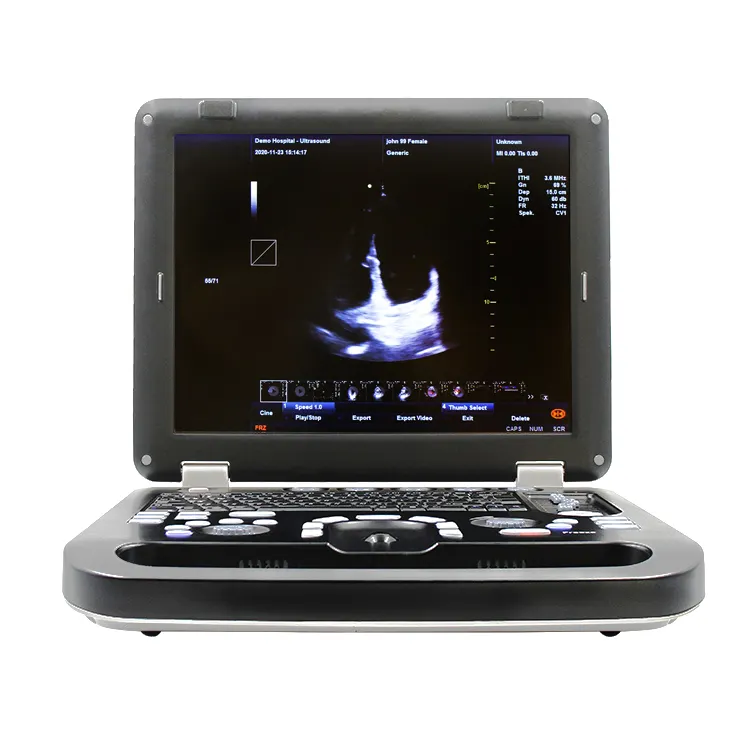 Contec CMS1700C Big Deal Draagbare Ultrasound Machine Kleur Doppler Medische Echografie Instrumenten