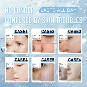 Máquina Facial de Limpieza Profunda con Oxígeno 14 en 1, Hidrodermoabrasión, Microdermoabrasión, Venta Caliente 2026 - Product Image 5