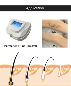 Máquina de Depilación Permanente por Electrólisis con Pantalla Digital, Cuerpo de Plástico Seguro para Uso Doméstico - Product Image 5