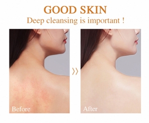 Loại Bỏ Mụn Trứng Cá Mụn Tùy Chỉnh Bao Bì Hương Vị Mụn Trứng Cá Điều Trị Cà Chua Cà Rốt Mặt Xà Phòng Lạnh Quá Trình Xà Phòng Nghệ Xà Phòng - Product Image 5