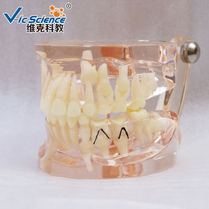 Modelo de Dientes Humanos para Ciencias Médicas, Modelo Patológico de Pérdida Prematura de Dientes Deciduos, Transparente, Mixto con Dientes Faltantes - Product Image 4