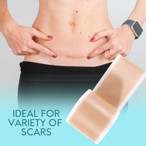 Elaimei Silicon Repair Damage Scar Sheet Gel Venta caliente Eliminación <span class=keywords><strong>de</strong></span> <span class=keywords><strong>cicatrices</strong></span> y marcas Acné Productos <span class=keywords><strong>de</strong></span> eliminación <span class=keywords><strong>de</strong></span> <span class=keywords><strong>cicatrices</strong></span> antiguas - Product Image 6