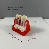 Modelo Dental de Enseñanza, Modelo de Estudio de Odontología, Implante Ortodóntico Extraíble, Modelos de Dientes para Práctica y Entrenamiento