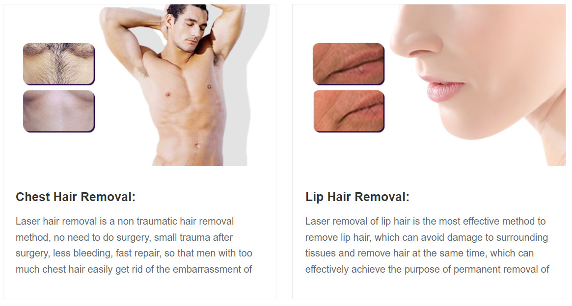 2023 new cooling technology 808 diode laser hair removal for hair loss treatment diodo laser depilacion