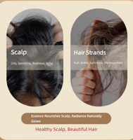 Si Mi Nong Organic 60ml Esens Jahe untuk Kulit Kepala - Perawatan Rambut yang Menyegarkan & Menenangkan untuk Kulit Kepala Berminyak & Akar Rambut Lemah