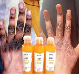 Tiktok 2022 novo mais eficaz laranja peeling loção juntas branqueamento óleos para remover a pele morta e branqueamento e alisamento