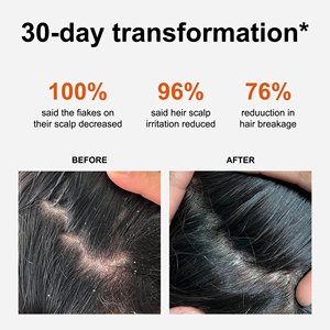 Sampo pereda gatal yang menenangkan eksim ketombe & <span class=keywords><strong>Psoriasis</strong></span> bantuan untuk kulit kepala sensitif & kering dengan Oatmeal dan Chamomile - Product Image 3